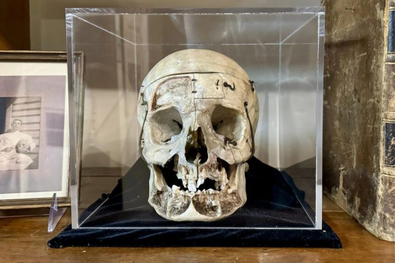 A human skull, once used as a reference tool by a North Carolina physician, on display at The Country Doctor Museum in Nash County.